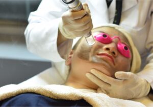 Điều trị sẹo lõm và vết thâm tại MDmedical